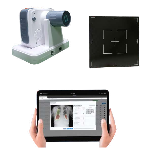 Chest X-ray with MIN-X Pro with Wireless Detector and Ai Software MIN-X Pro